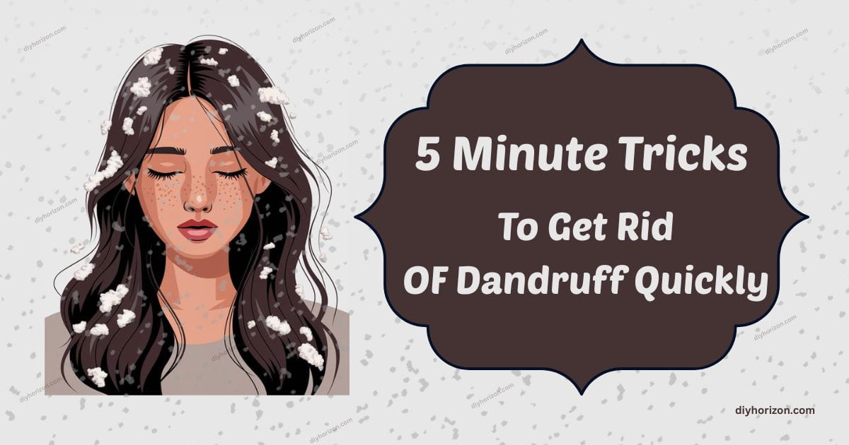 Get Rid of Dandruff