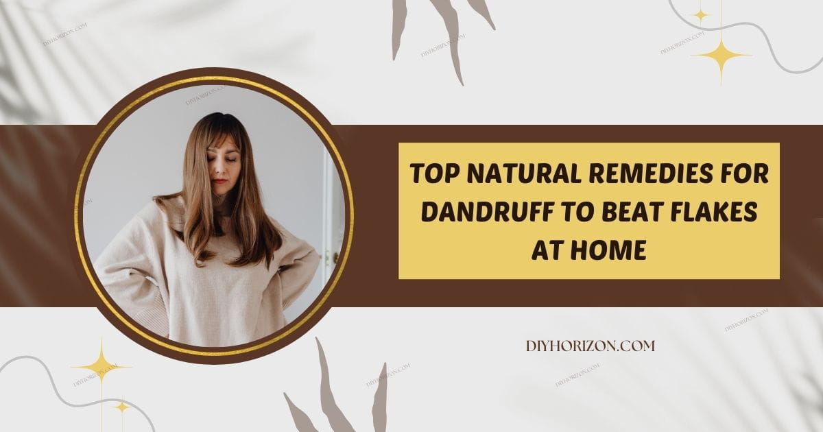 natural remedies for dandruff