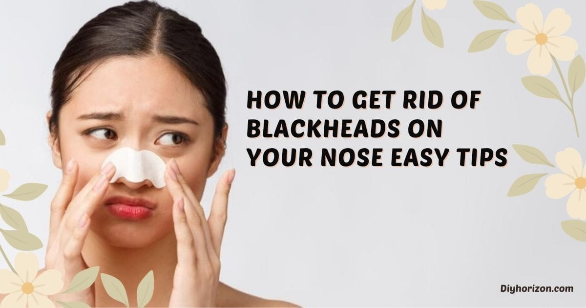 Get Rid of Blackheads on Your Nose